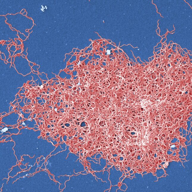 igitally colorized scanning electron microscopic (SEM) image depicts a grouping of numerous, Gram-negative, anaerobic, Borrelia burgdorferi bacteria, which had been derived from a pure culture. This pathogenic organism is responsible for causing the illness, Lyme disease, a zoonotic, vector-borne, ailment, transmitted to humans by way of a tick bite. -- infectious disease coverage from STAT