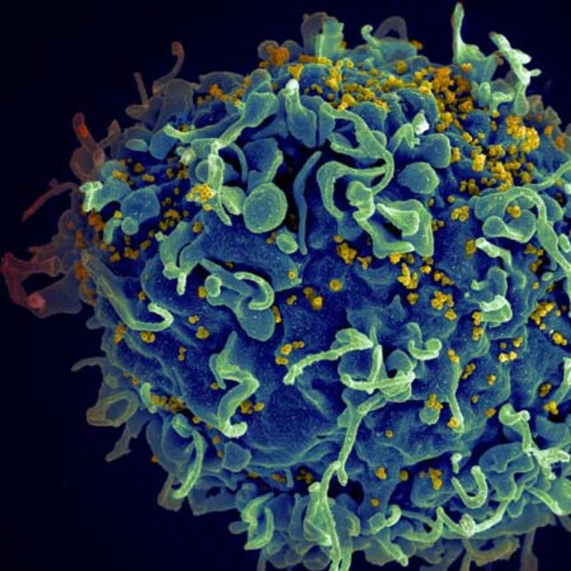 HIV viruses in yellow attack human T cell in blue — in the lab coverage from STAT