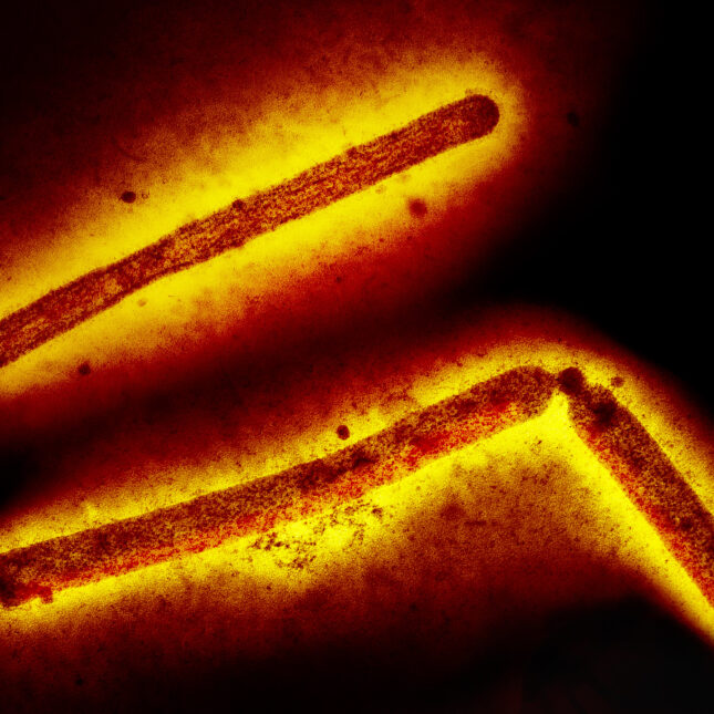 Three influenza A (H5N1, bird flu, avian flu) virus particles (rod-shaped). Note: Layout incorporates two CDC transmission electron micrographs that have been inverted, repositioned, and colorized by NIAID. Scale has been modified.