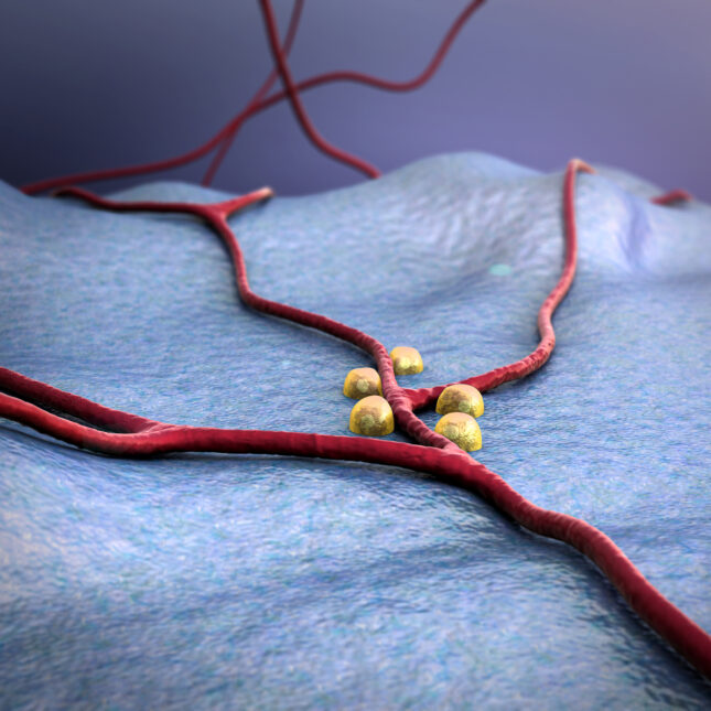 Beta cells in yellow on the periwinkle blue surface of pancreas — coverage from STAT