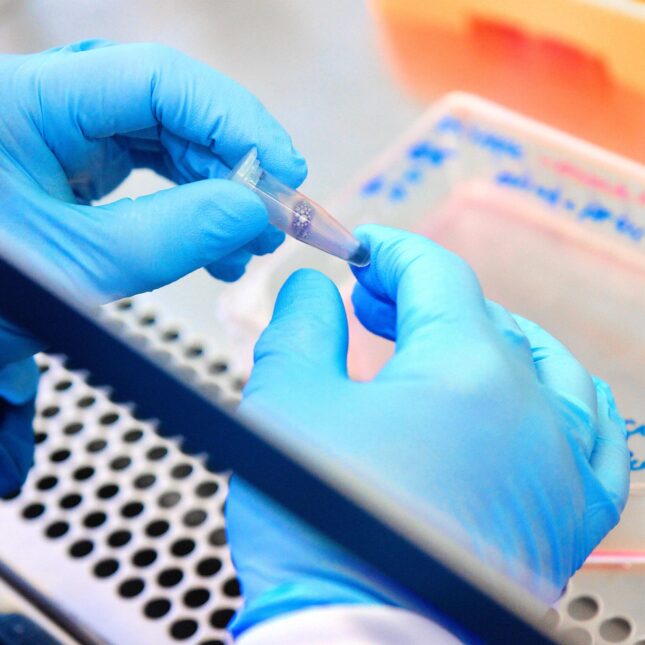 A researcher handles a PCR tube that contains translucent indigo liquid in a lab — biotech coverage from STAT